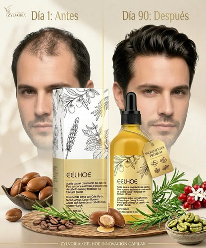 Veganic™ - Aceite Natural para el Crecimiento del Cabello